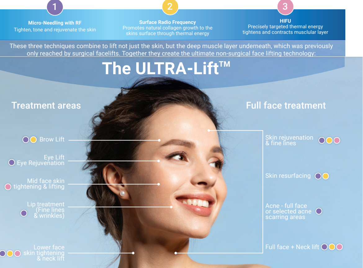 final version for ultracel 2