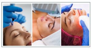 Microneedling vs. Chemical Peels vs. Laser: Which Skin Treatment Is Right for You?