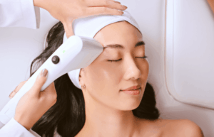 Sofwave treatment at Wessex Skin Clinic in Winchester UK
