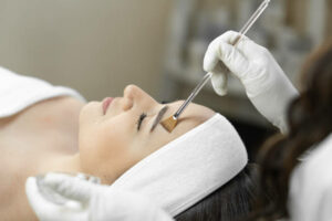 Chemical Peel Treatment
